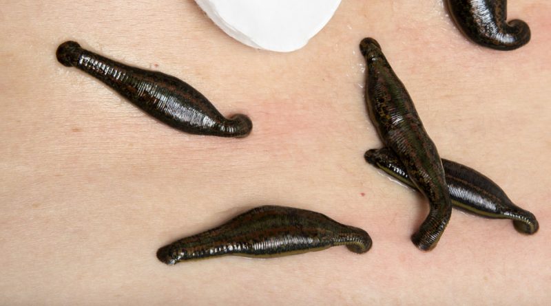 Каких результатов позволяют достичь пиявки и где купить в Украине